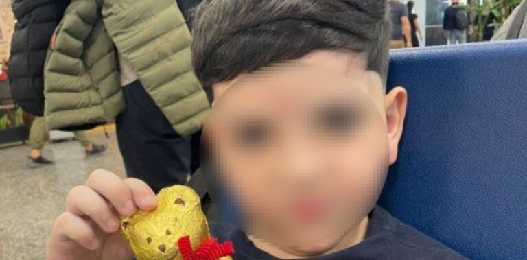 Traqueotomía a Bastián: por qué fue clave tras 14 días de asistencia mecánica para ayudarlo a respirar