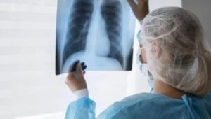 Día Mundial de la Tuberculosis: alerta por fuerte aumento de casos en Argentina