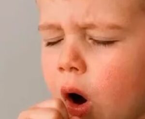 Coqueluche en Argentina: crecen los casos y alertan por niños