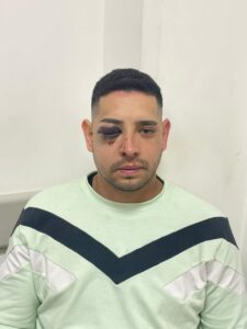 Imputarán por lesiones graves a un policía que le dio una golpiza a un hombre en el B°292 Viviendas