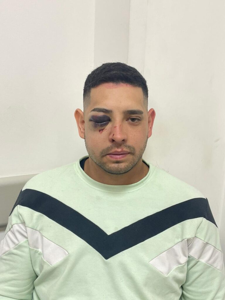Imputarán por lesiones graves a un policía por una golpiza a un hombre en el B°292 Viviendas