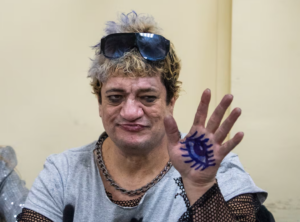 Pity Álvarez fue internado tras una crisis hipertensiva