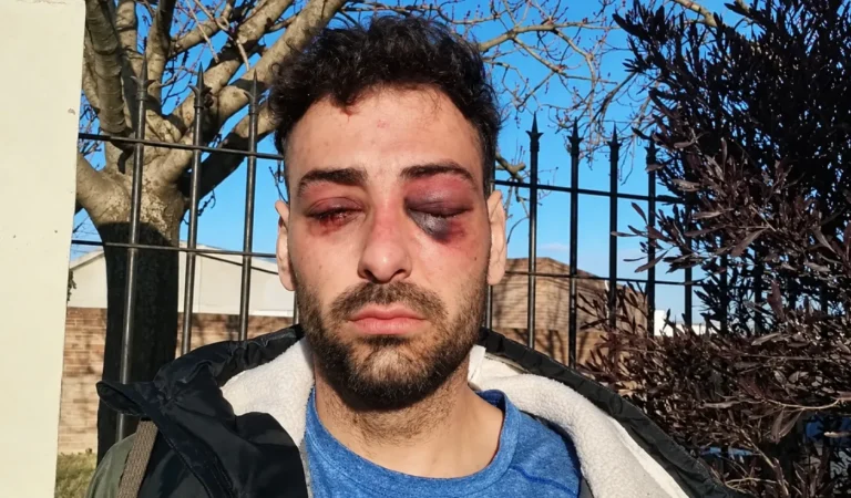 VIDEO | Un músico denunció golpes, asfixia y torturas durante una detención en La Pampa